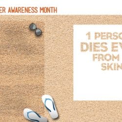 Get involved to cure Melanoma Skin Cancer