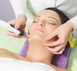 Microneedling Skin Treatment