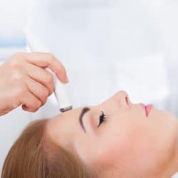 Microneedling with platelet-rich plasma (PRP) is an increasingly-popular treatment for acne scars, wrinkles, fine lines and more.